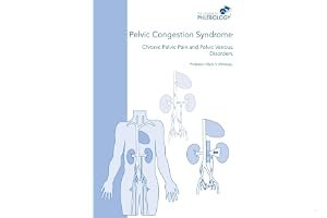 Pelvic Congestion Syndrome - Chronic Pelvic Pain and Pelvic Venous Disorders book cover
