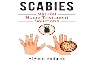 Scabies Natural Home Treatment Solution book cover