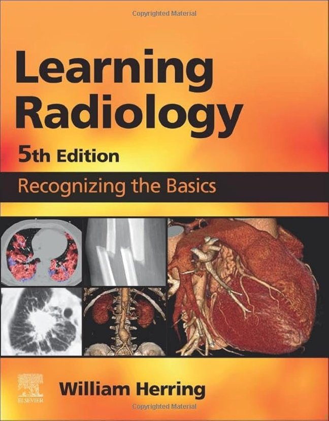Learning Radiology: Recognizing the Basics book cover