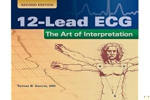 12-Lead Ecg: The Art of Interpretation book cover