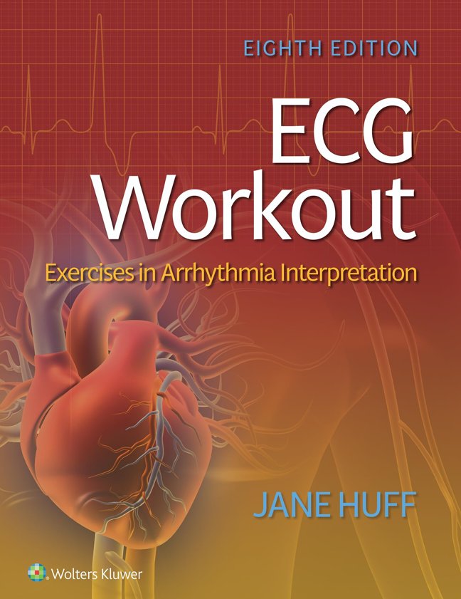 ECG Workout: Exercises in Arrhythmia Interpretation book cover