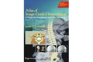 Atlas of Image-Guided Intervention in Regional Anesthesia and Pain Medicine book cover