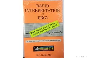 Rapid Interpretation of EKG's book cover