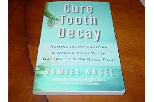 Cure Tooth Decay: Heal and Prevent Cavities with Nutrition book cover