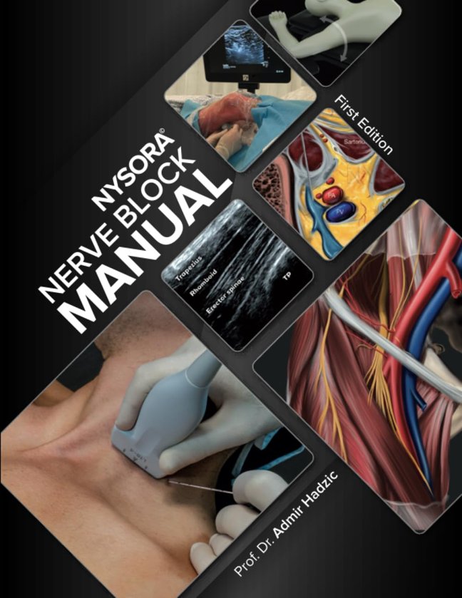NYSORA Nerve Block Manual: First Edition (Regional Anesthesia) book cover