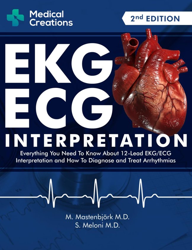 EKG/ECG Interpretation: Everything you Need to Know about the 12 - Lead ECG/EKG Interpretation and How to Diagnose and Treat Arrhythmias book cover